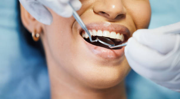 Best Chipped Tooth Repair Near Me  in Richmond Heights, OH
