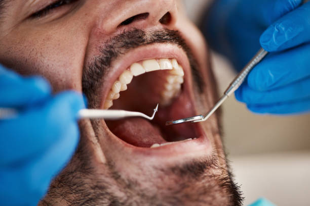 Best Emergency Dentist Near Me  in Richmond Heights, OH